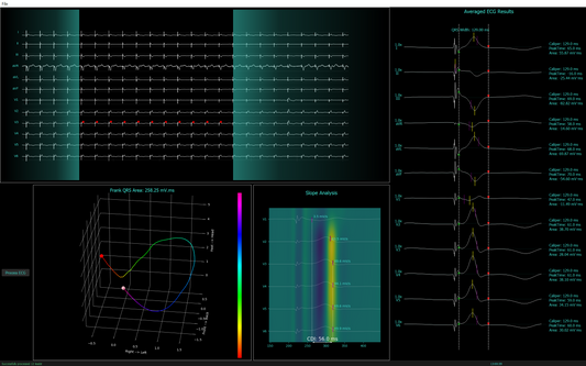 SyncView v0.1 Advanced ECG Analysis - RESEARCH for MAC